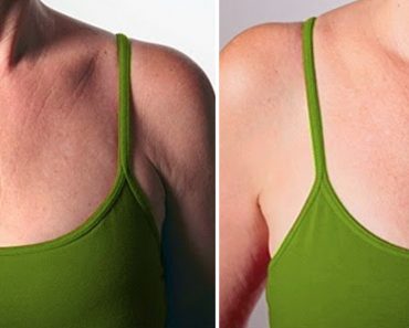 9 remedios respaldados por la ciencia para minimizar las arrugas de tu pecho