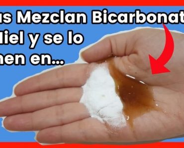 ¡Mezcle MIEL con Bicarbonato y sus Amigas la adoraran Una vez que le cuente de esto! ¡Mezcle MIEL con Bicarbonato y sus Amigas la adoraran Una vez que le cuente de esto!