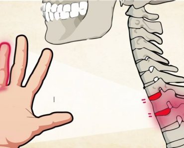 ¿Por qué se te Entumen las Manos? – 5 Razones para que Prestes más Atención a tu Salud