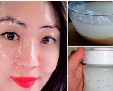 Botox japones casero para quitar  años de arrugas y blanquear el rostro instantáneamente