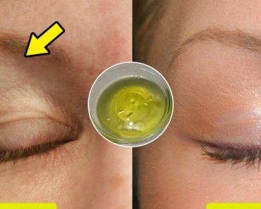 Levante sus párpados caídos y borre las arrugas de su contorno en menos de 10 días con esta receta