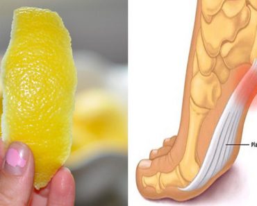 Una Cáscara de Limón puede quitar el Dolor de las Articulaciones para siempre Una Cáscara de Limón puede quitar el Dolor de las Articulaciones para siempre