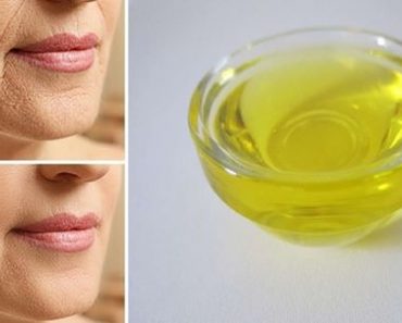 Rostro libre de arrugas y líneas de expresión con este Serum Casero