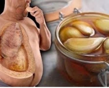 Mezcla Ajo y Miel tómalo en ayuna y olvídate de Colesterol, Presión Alta, Mala Circulación. Mezcla Ajo y Miel tómalo en ayuna y olvídate de Colesterol, Presión Alta, Mala Circulación.