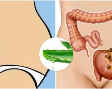Expulsa todo desecho del COLON en un dia con ALOE VERA Y LIMÓN para dejarlo vacio. Expulsa todo desecho del COLON en un dia con ALOE VERA Y LIMÓN para dejarlo vacio.