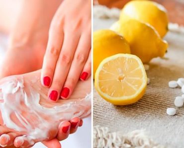 Aspirina Y Jugo De Limón Para Borrar De Raíz Los Callos De Los Pies Y El Mal Olor