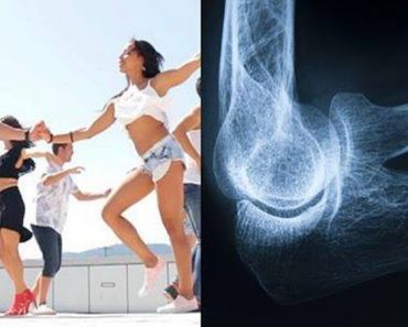 Bailar ayuda a prevenir la osteoporosis, según expertos