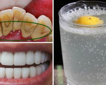 EL REMEDIO DE ORO, aceite de coco con BICARBONATO para remover el SARRO y el MAL ALIENTO
