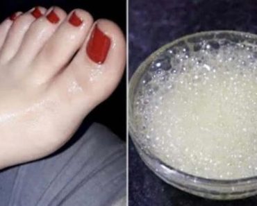 Blanqueador de pies, manos, rostro, axilas y cuello. Limpia años de suciedad en minutos Blanqueador de pies, manos, rostro, axilas y cuello. Limpia años de suciedad en minutos