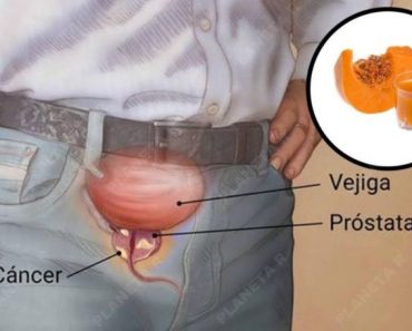 Desinflama Tu Próstata De Forma Segura Y Natural : Esta Receta Es Muy Barata