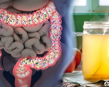 ¡Utilice esta Mezcla para Extraer Libras de Desechos Tóxicos de su Colon!
