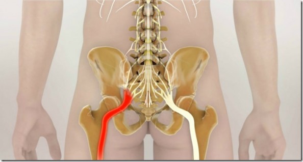 CÓMO DESBLOQUEAR EL NERVIO CIÁTICO: 2 MANERAS SENCILLAS PARA ALIVIAR EL DOLOR. CÓMO DESBLOQUEAR EL NERVIO CIÁTICO: 2 MANERAS SENCILLAS PARA ALIVIAR EL DOLOR.